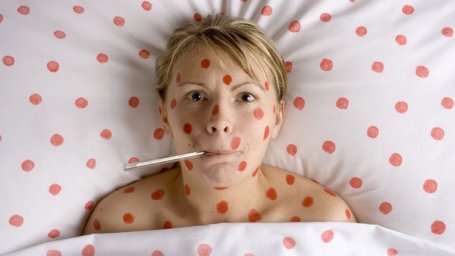 На Черкащині лютує кір На Черкащині лютує кір